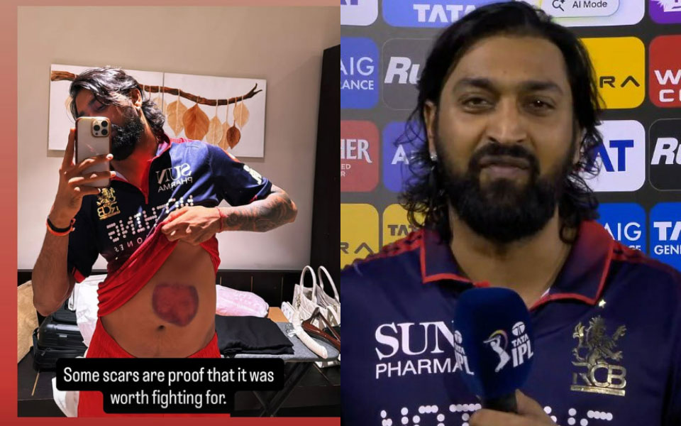 IPL 2026: Krunal Pandya shows off his battle scar after match-winning knock in RCB vs MI