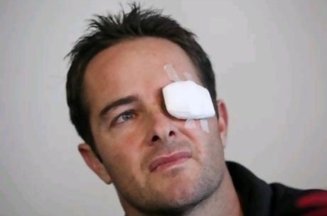 Mark Boucher eye injury