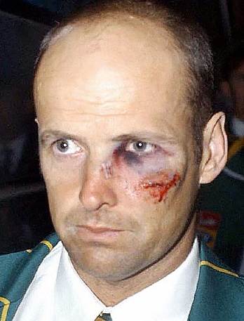 The former South African opener Gary Kirsten was badly injured by Pakistani fast bowler Shoaib Akhtar. (Photo Source: Getty Images)