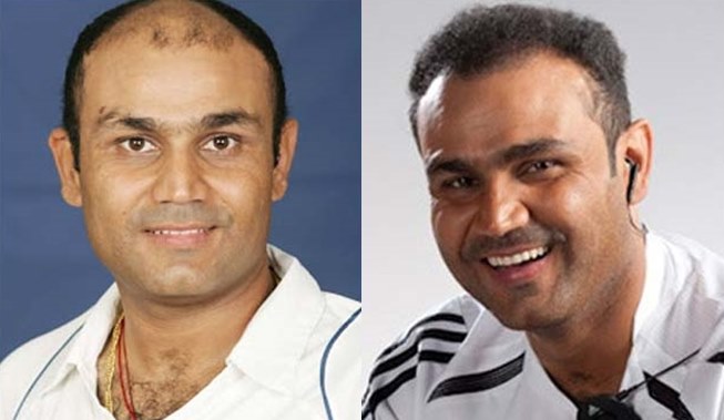 Page 9: 10 Cricketers who went for a hair transplant