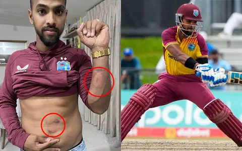 Nicholas Pooran